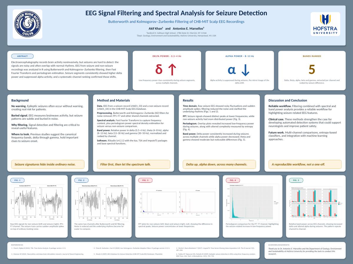 First page preview of EEG seizure poster